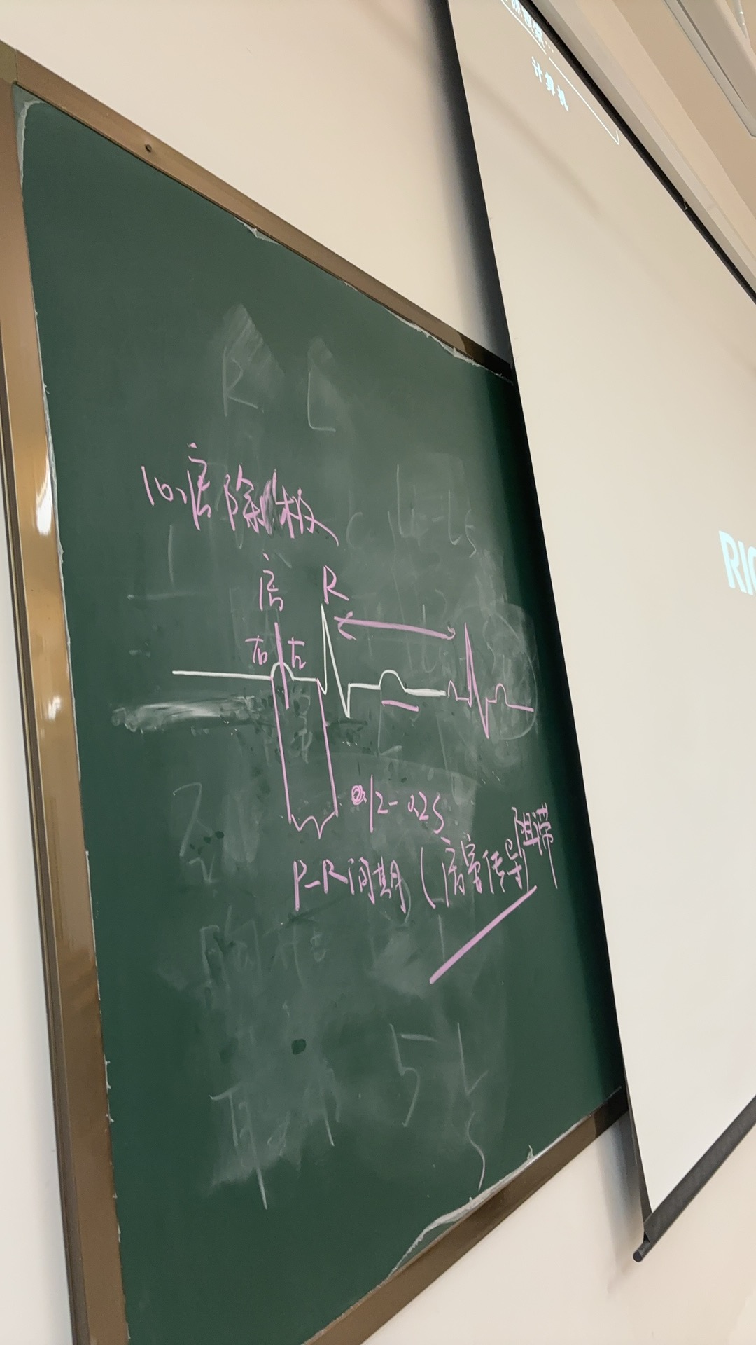 医学课堂黑板笔记
